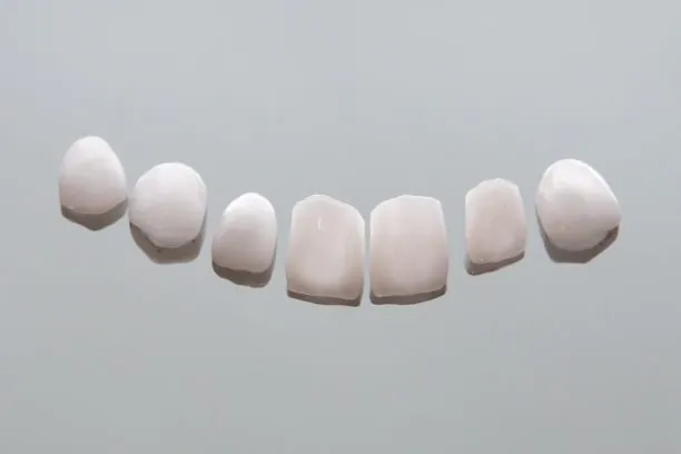 Carillas Dentales 12 Dental Veneers
