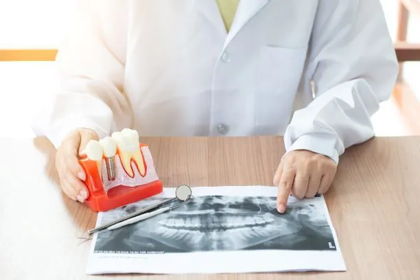 Implantes Dentales para Personas Mayores 6 dentist with dental