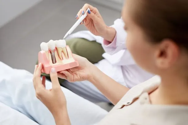 Dentist Oxnard 21 dental implants in oxnard