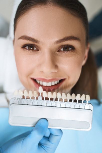 El juego de los famosos con carillas dentales • Clínica Dental AVODENT