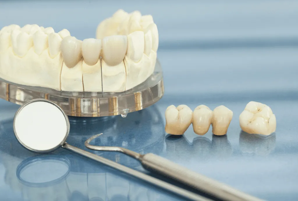 Porcelain Crowns 23 Porcelain Crowns