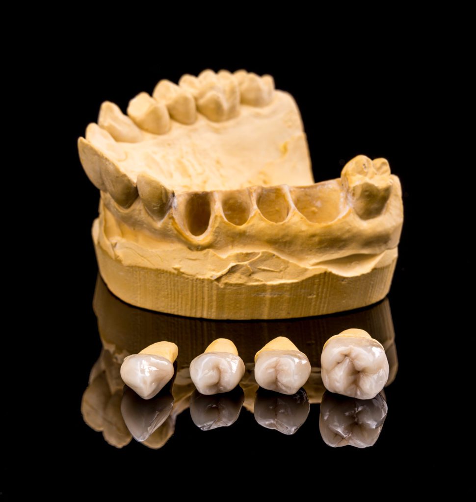 Ceramic dental implants