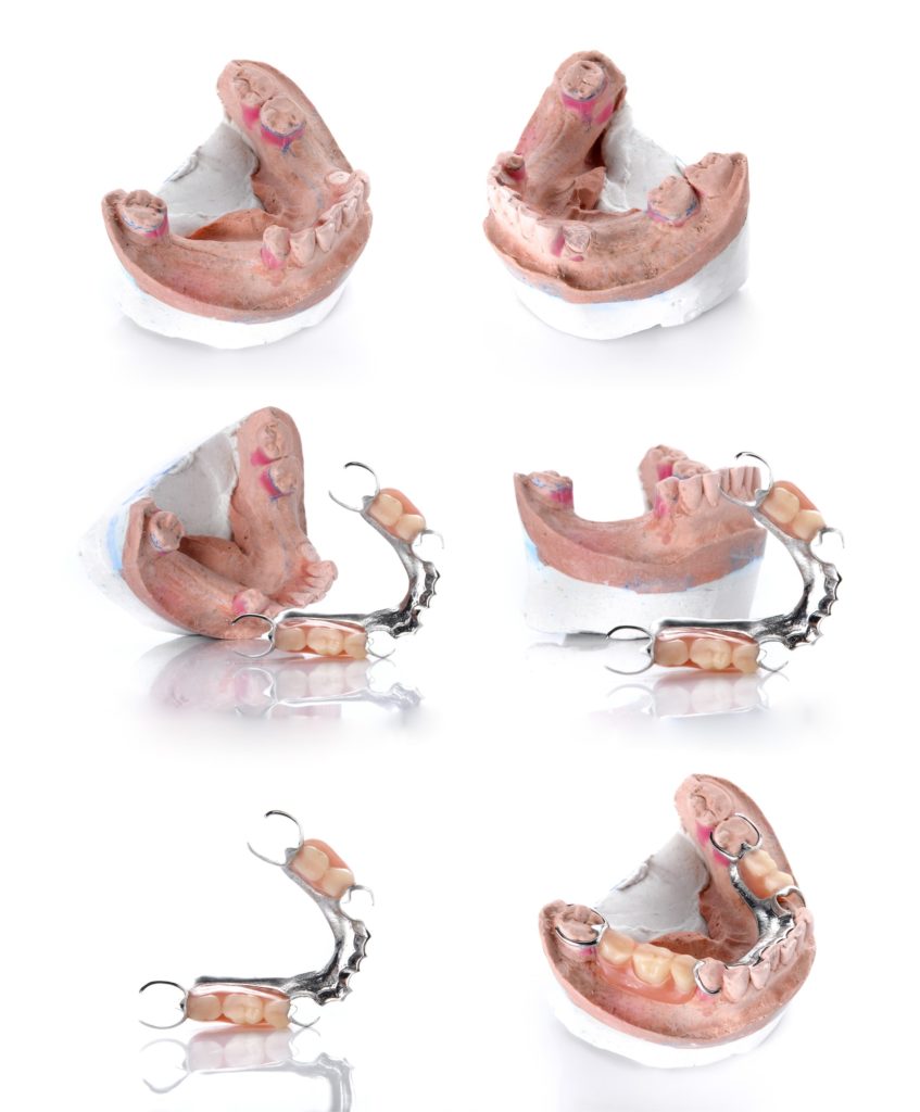 collection denture mold false teeth on white background