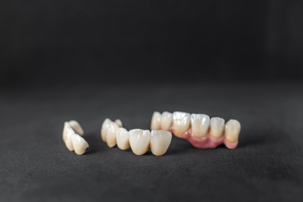 Coronas de Porcelana 5 dental crowns on the black background