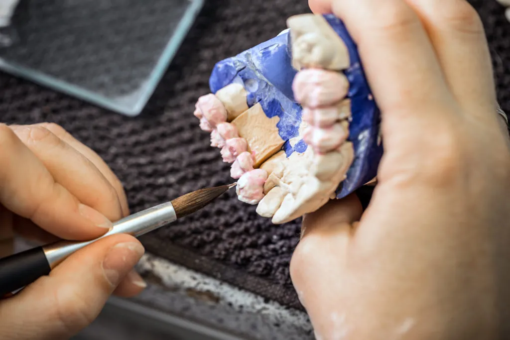 Porcelain Crowns 16 Dental technician working