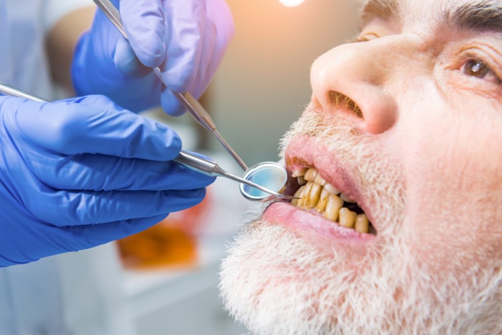 Dentist examining patient, close up
