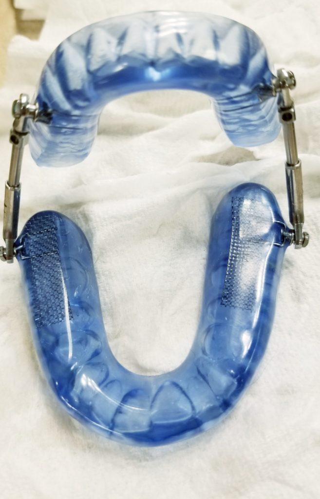 obstructive sleep apnea mandibular oral device