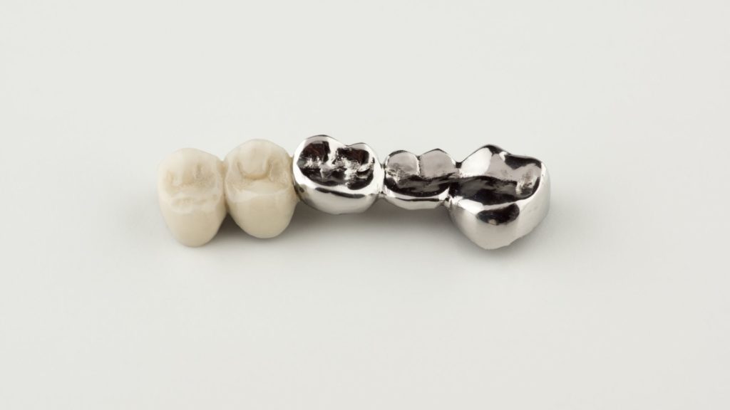 Dental Bridge 2 TEETH