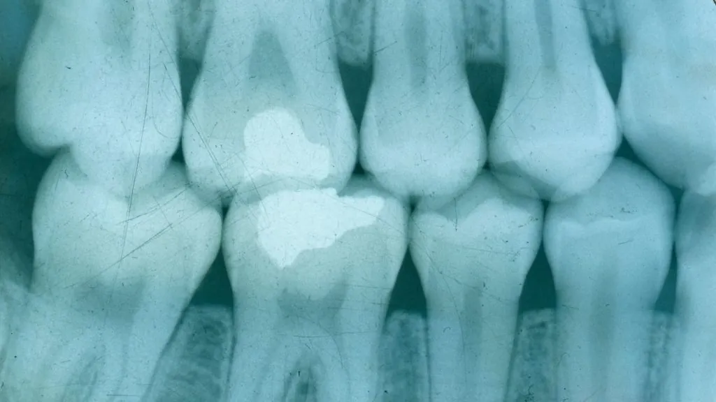 Imagen Dental Intraoral 8 intraoral dental
