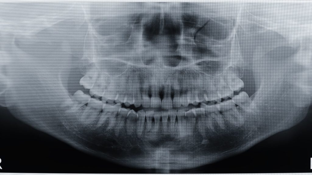 Intraoral Dental Imaging 6 intraoral dental imaging