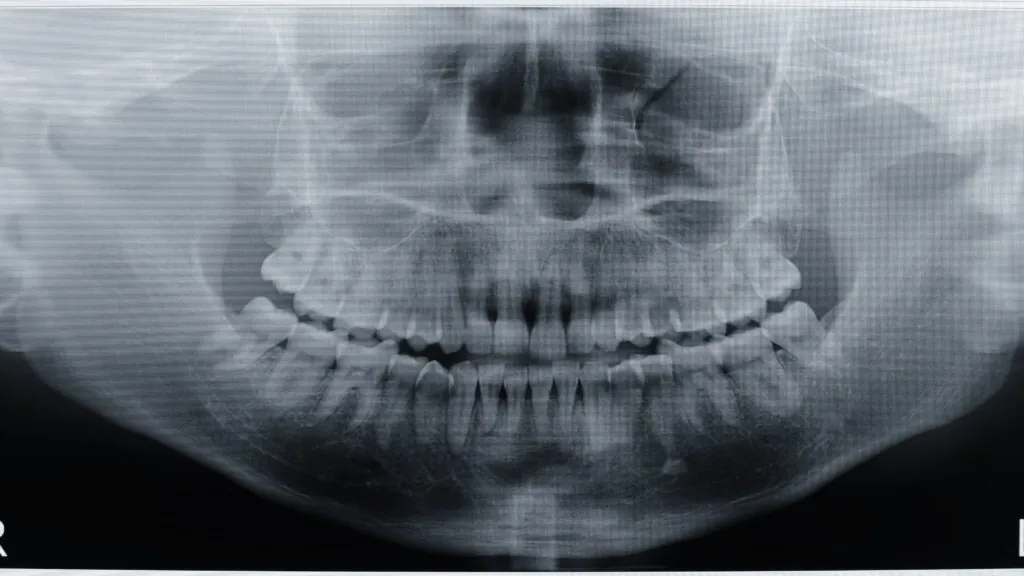 Imagen Dental Intraoral 6 intraoral dental imaging