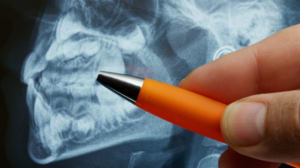 Intraoral Dental Imaging 8 intraoral dental imaging