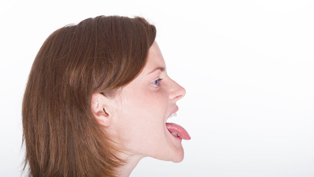 cleft lip and cleft palate