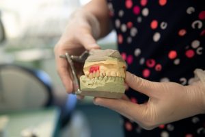 dental mold image