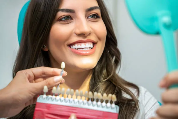 Blanqueamiento Dental 12 Dental Veneers