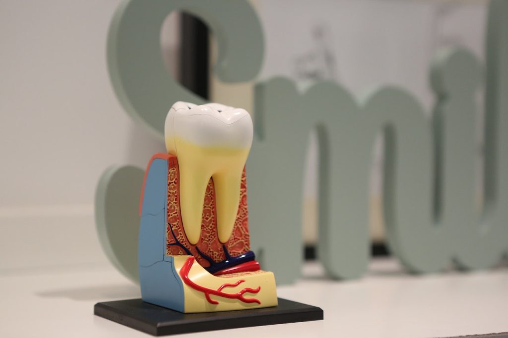 Tooth sculpture