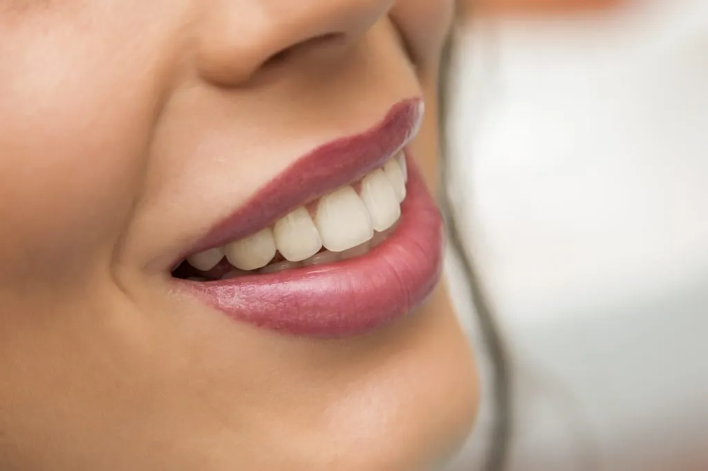 Dental Bridge 7 Aesthetic smile