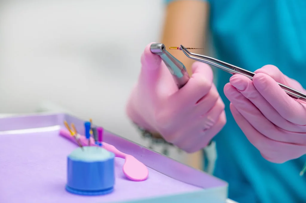 Oxnard Dentistry 17 preparing for root canal treatment