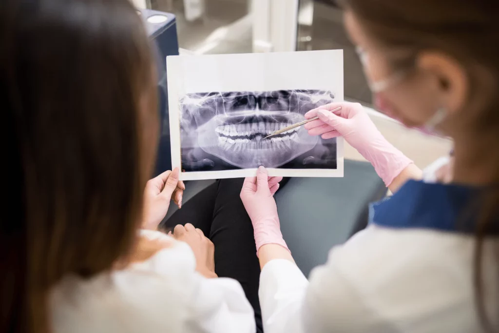 Dentists Oxnard 23 Dental X-Ray