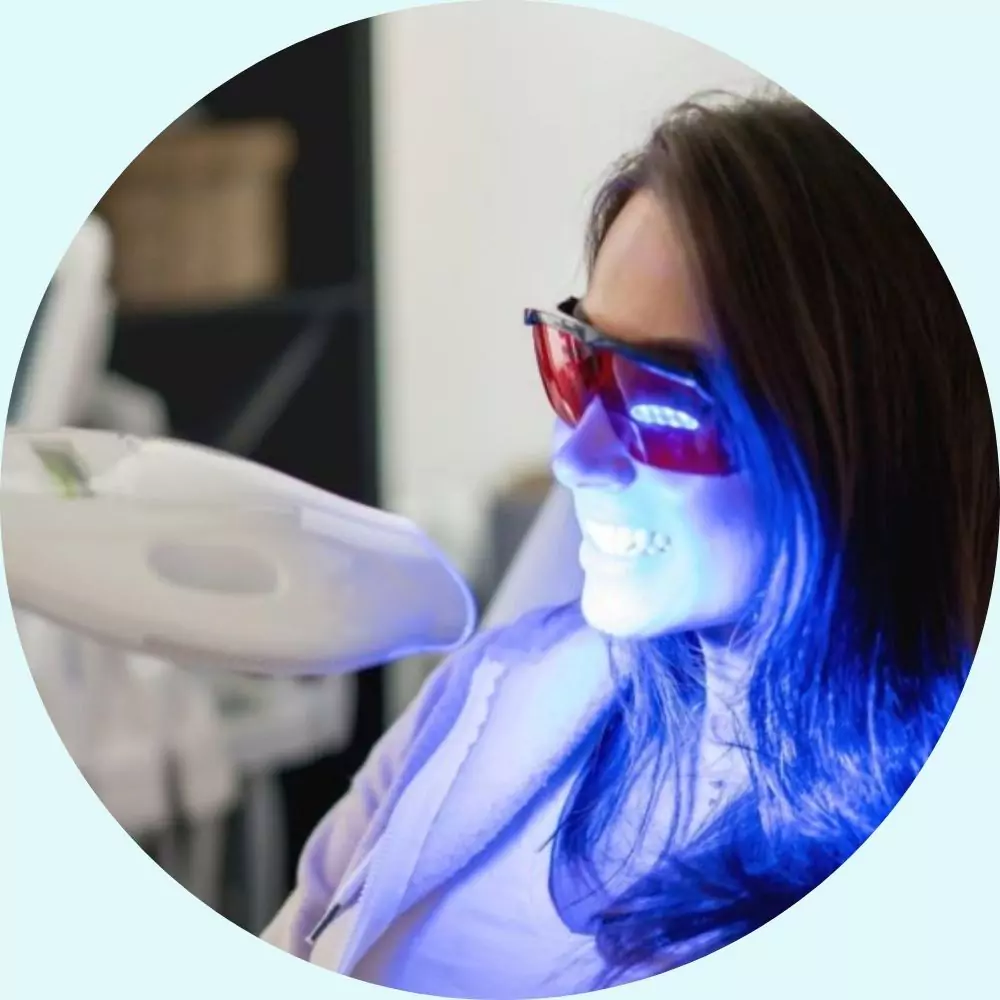 Cosmética Dental 21 laser teeth whitening treatment