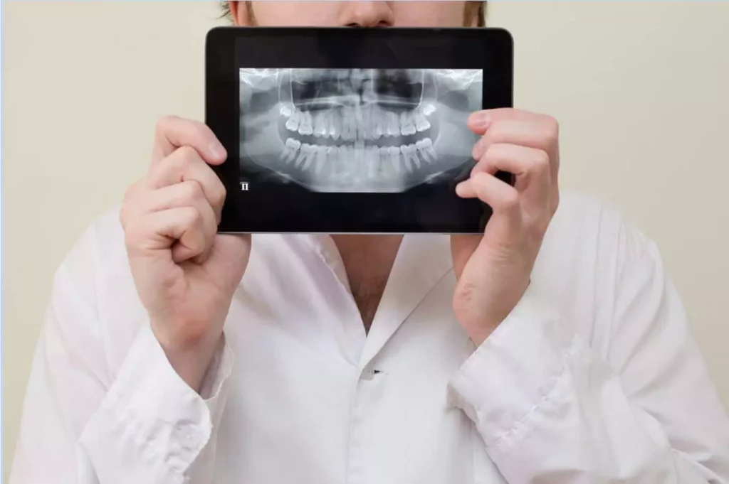 Dental X-Rays 12 dental x-rays
