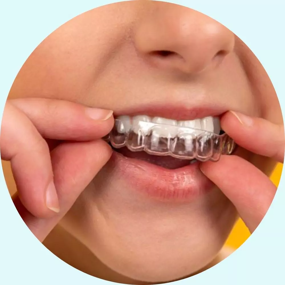 Cosmética Dental 16 Invisalign Aligners