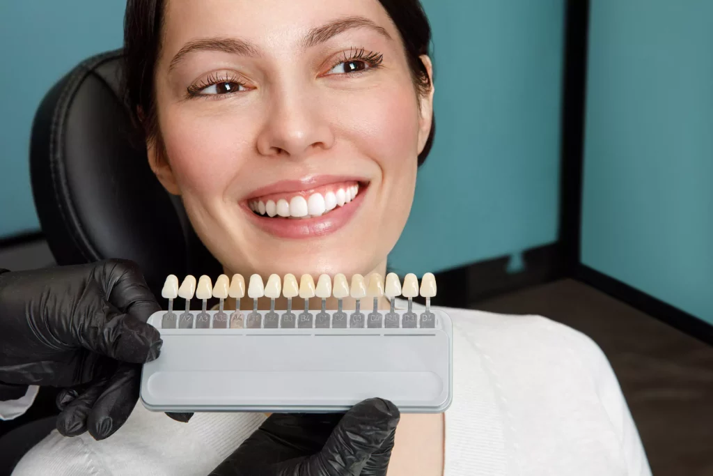 Dental veneers