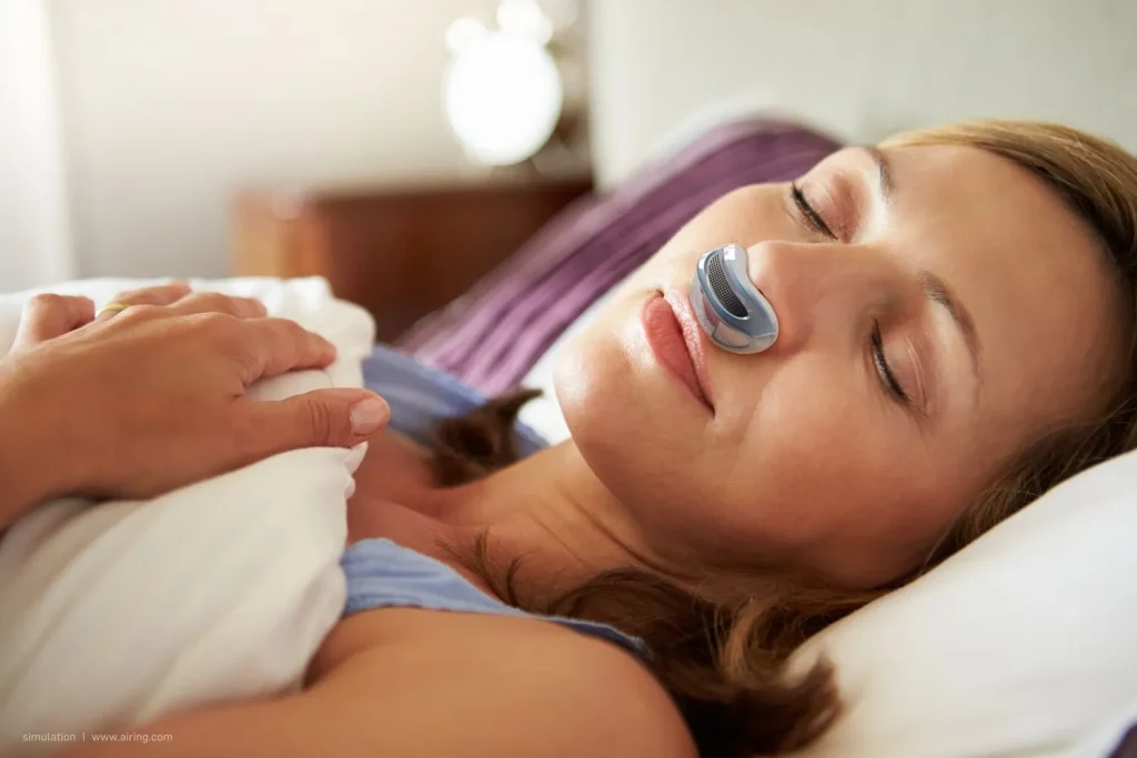 Apnea del Sueño 16 Sleep Apnea dental