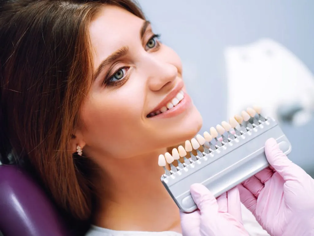 Dental Financing 5 Dental Veneers