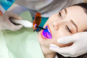 client-woman-doing-laser-whitening-scaled-1-680a45fe81a7c.webp