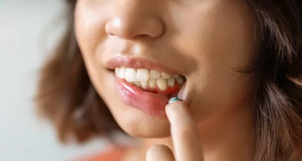 Dental Cleaning in Oxnard: A Complete Patient Guide 2 Warning signs you should never ignore