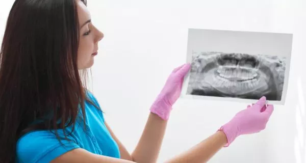 Intraoral Periapical X-Rays in Oxnard | Same-Day Appointment 1 What are intraoral periapical x-rays?