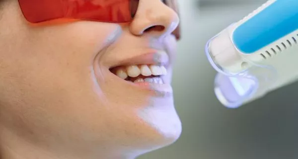 What is teeth whitening?