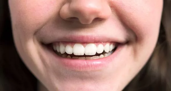 Benefits of root canal treatment