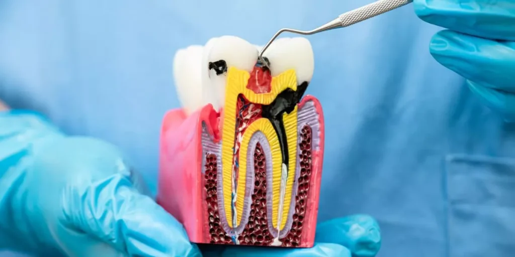 Especialista en Conducto Radicular en Oxnard