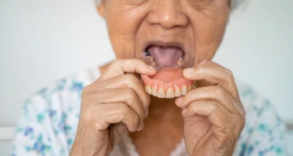 Affordable Dentures in Oxnard | Channel Islands Family Dental 2 Who needs dentures?